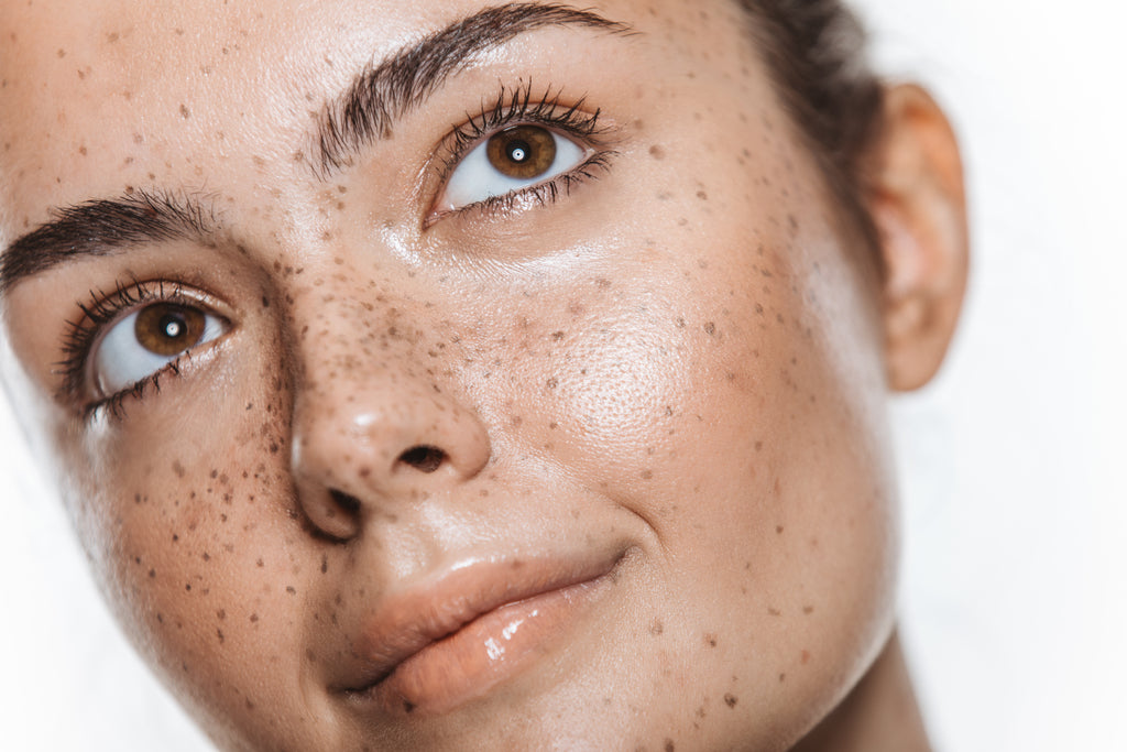 Woman with freckles looking up